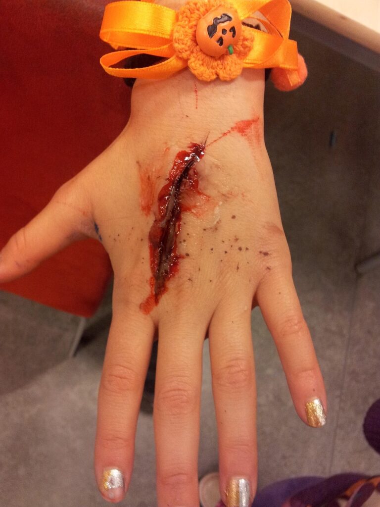 hand, wound, halloween, costume, bloody, fake, injury, accident, human, fingers, injured, trauma, wounded, emergency, pain, medical